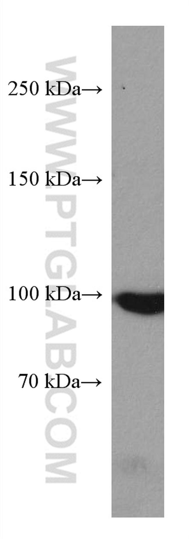 MARS Antibody in Western Blot (WB)