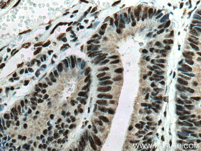 EIF4A3 Antibody in Immunohistochemistry (Paraffin) (IHC (P))