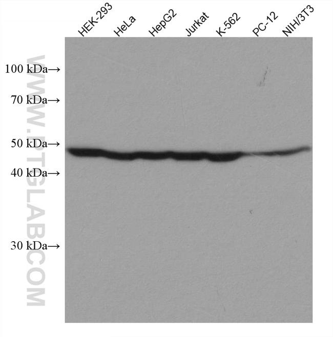 EIF4A3 Antibody in Western Blot (WB)