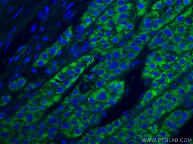 ACADM Antibody in Immunohistochemistry (Paraffin) (IHC (P))