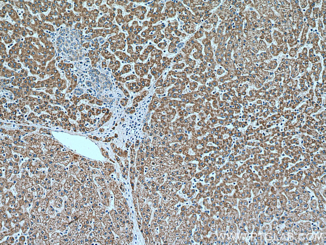 ACADM Antibody in Immunohistochemistry (Paraffin) (IHC (P))