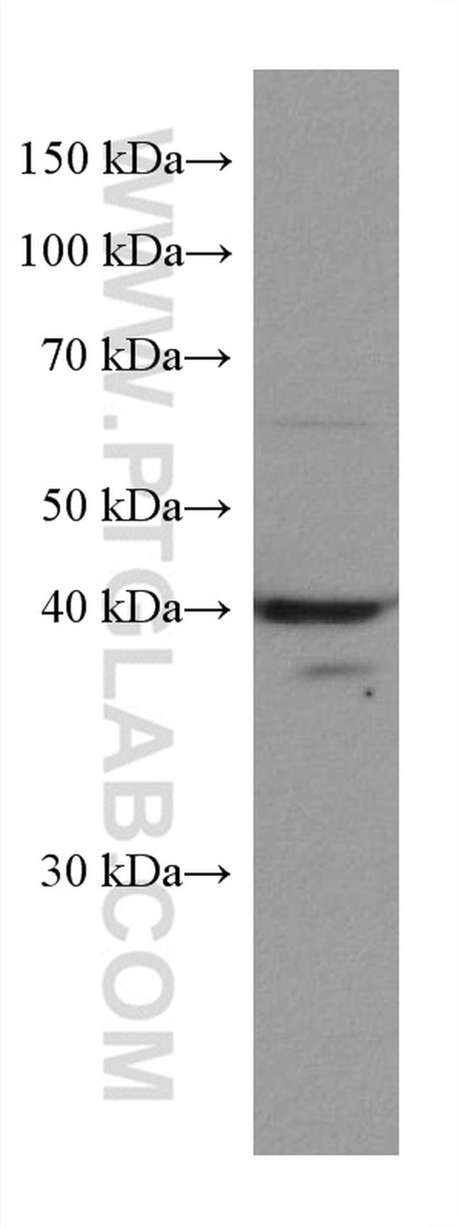 ACADM Antibody in Western Blot (WB)