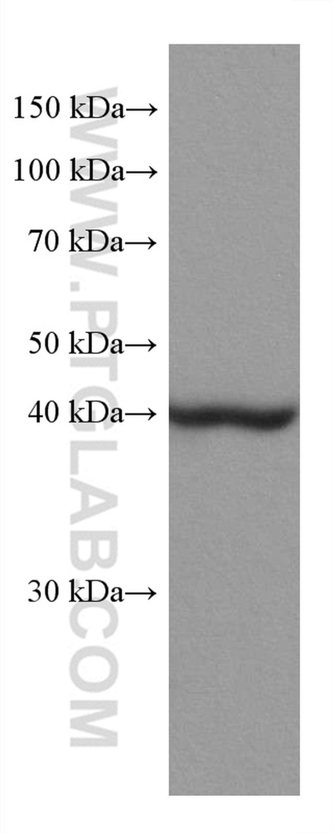 ACADM Antibody in Western Blot (WB)