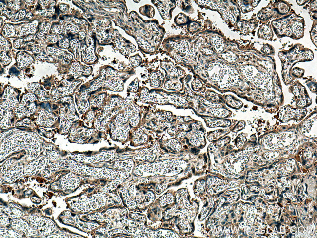 PTPN14 Antibody in Immunohistochemistry (Paraffin) (IHC (P))