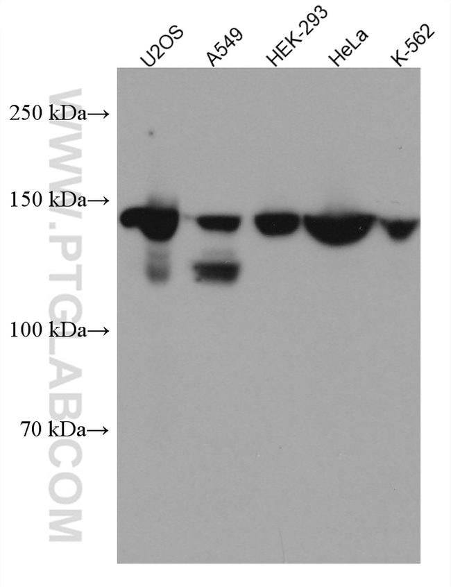 PTPN14 Antibody in Western Blot (WB)