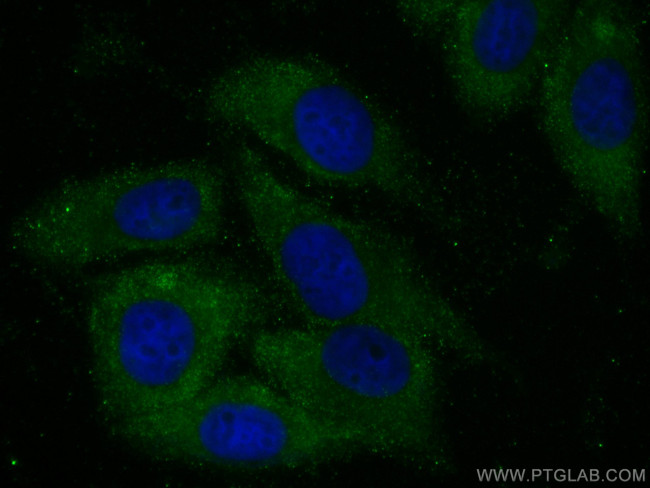 USP14 Antibody in Immunocytochemistry (ICC/IF)