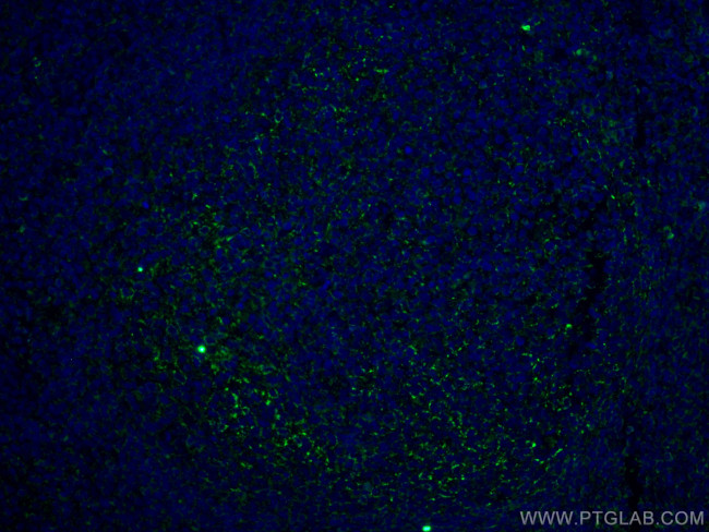 CD70 Antibody in Immunohistochemistry (Paraffin) (IHC (P))