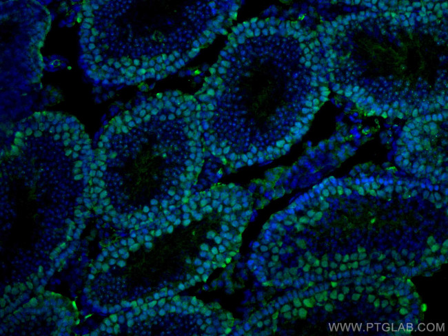 EED Antibody in Immunohistochemistry (Paraffin) (IHC (P))