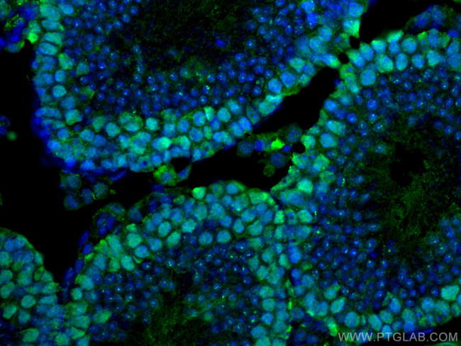 EED Antibody in Immunohistochemistry (Paraffin) (IHC (P))