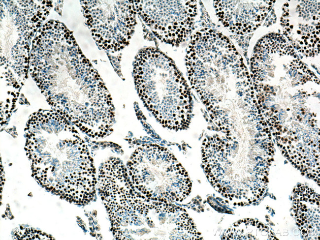 EED Antibody in Immunohistochemistry (Paraffin) (IHC (P))