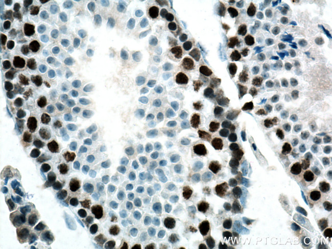 EED Antibody in Immunohistochemistry (Paraffin) (IHC (P))