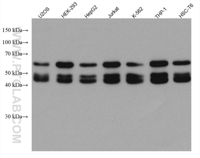 EED Antibody in Western Blot (WB)