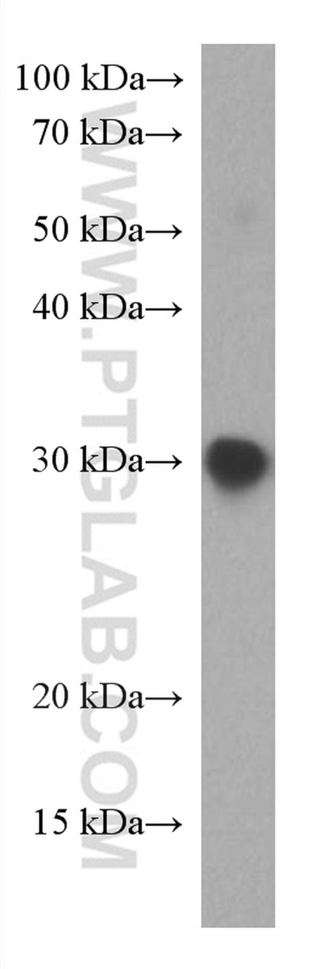 SARS-CoV-2 S protein (319-541 aa) Antibody in Western Blot (WB)