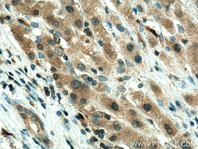 GPX4 Antibody in Immunohistochemistry (Paraffin) (IHC (P))