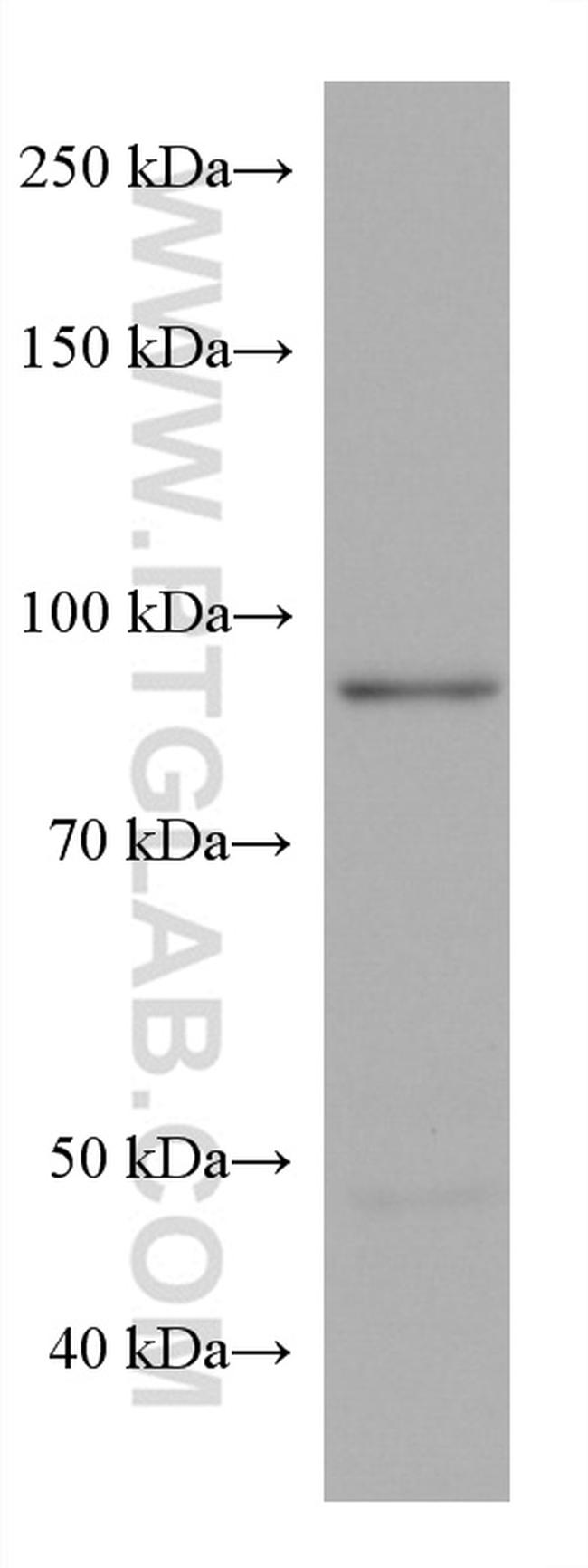 ADARB1 Antibody in Western Blot (WB)