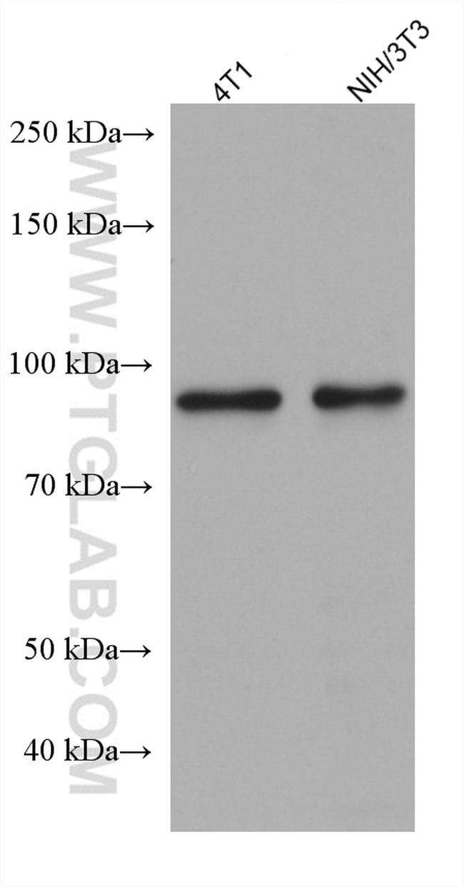 ADARB1 Antibody in Western Blot (WB)