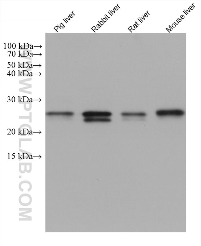 SAR1B Antibody in Western Blot (WB)