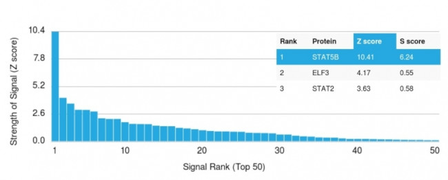 STAT5B Antibody in Peptide array (ARRAY)