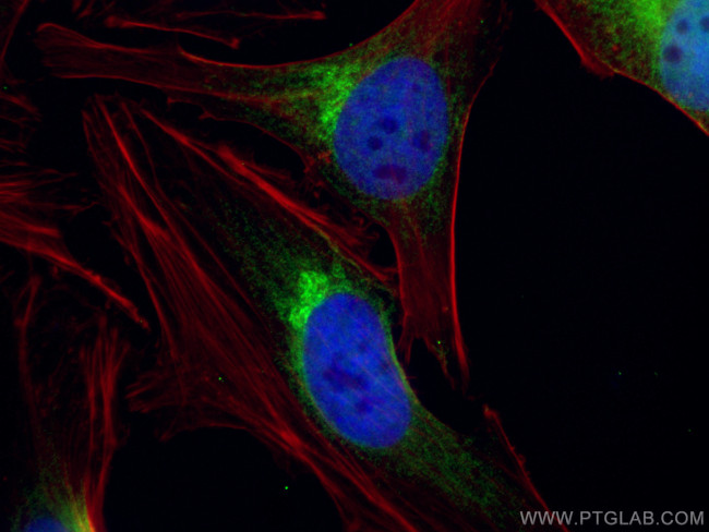 GOLPH3 Antibody in Immunocytochemistry (ICC/IF)