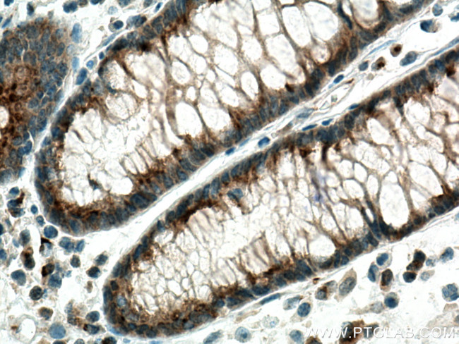 GOLPH3 Antibody in Immunohistochemistry (Paraffin) (IHC (P))