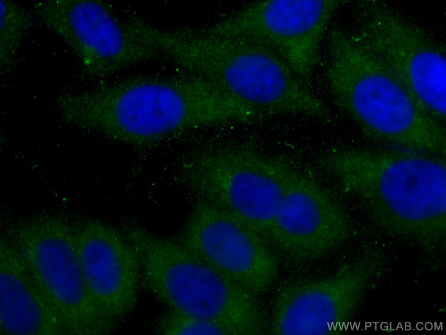 ABHD5 Antibody in Immunocytochemistry (ICC/IF)