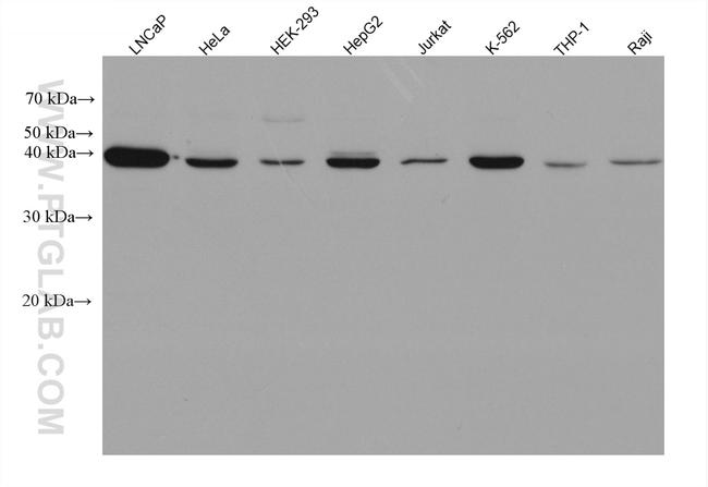 ABHD5 Antibody in Western Blot (WB)