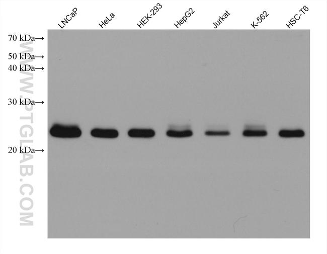 RAB11B Antibody in Western Blot (WB)