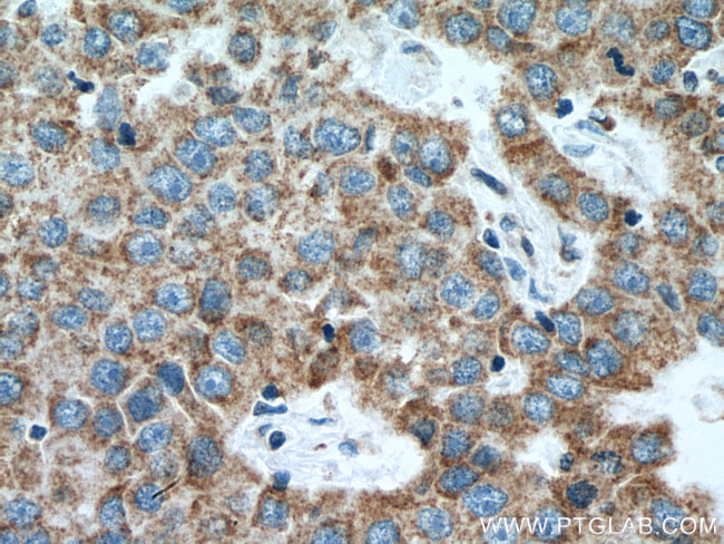 citrate synthase Antibody in Immunohistochemistry (Paraffin) (IHC (P))