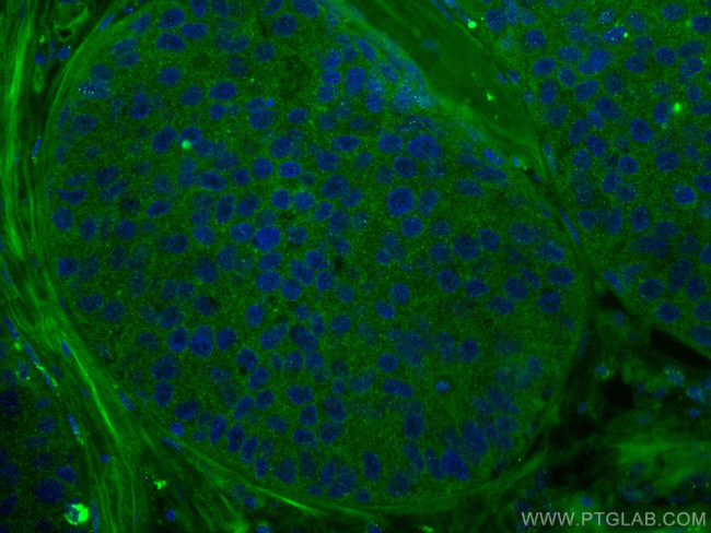 AHR Antibody in Immunohistochemistry (Paraffin) (IHC (P))