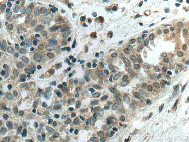 AHR Antibody in Immunohistochemistry (Paraffin) (IHC (P))