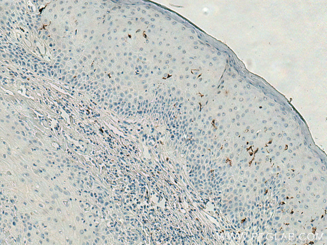 CD207 Antibody in Immunohistochemistry (Paraffin) (IHC (P))