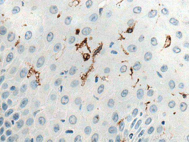 CD207 Antibody in Immunohistochemistry (Paraffin) (IHC (P))