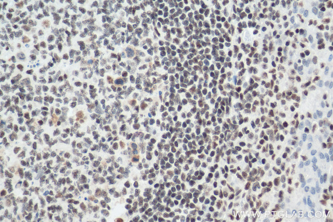 IFI16 Antibody in Immunohistochemistry (Paraffin) (IHC (P))