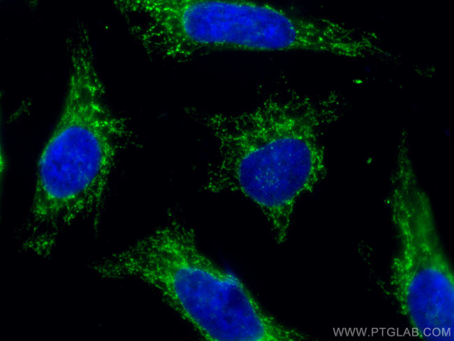 AIF Antibody in Immunocytochemistry (ICC/IF)