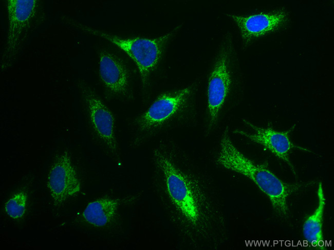 AIF Antibody in Immunocytochemistry (ICC/IF)