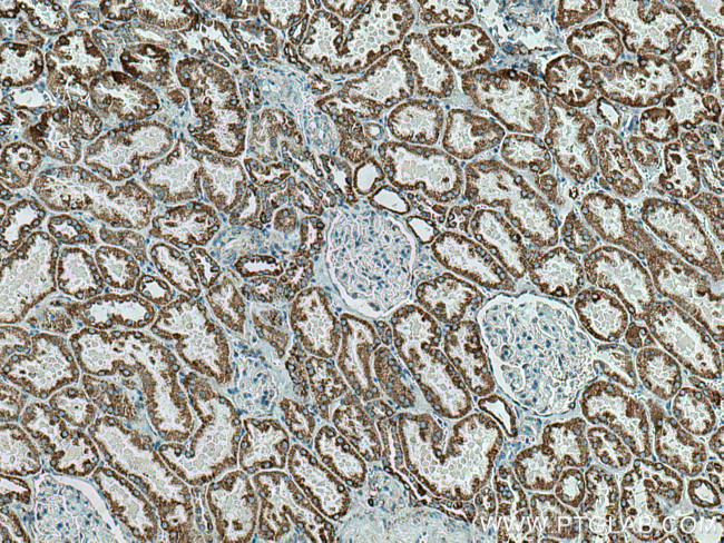 AIF Antibody in Immunohistochemistry (Paraffin) (IHC (P))