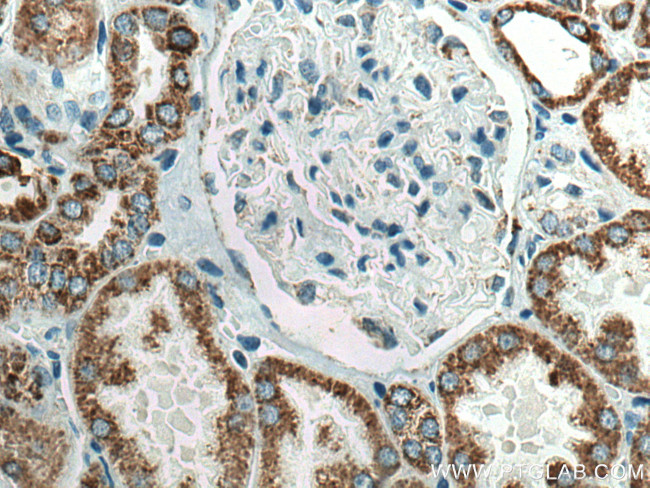 AIF Antibody in Immunohistochemistry (Paraffin) (IHC (P))