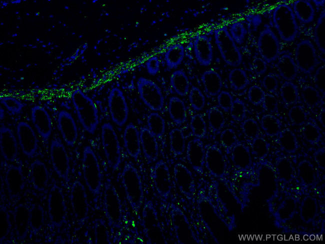 Desmin Antibody in Immunohistochemistry (Paraffin) (IHC (P))