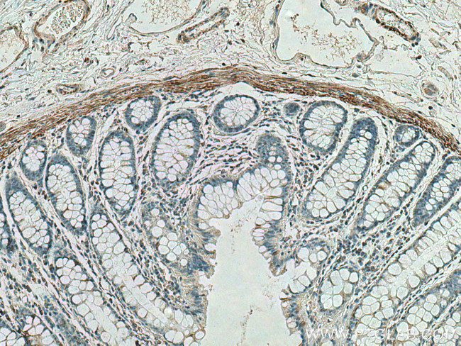 Desmin Antibody in Immunohistochemistry (Paraffin) (IHC (P))