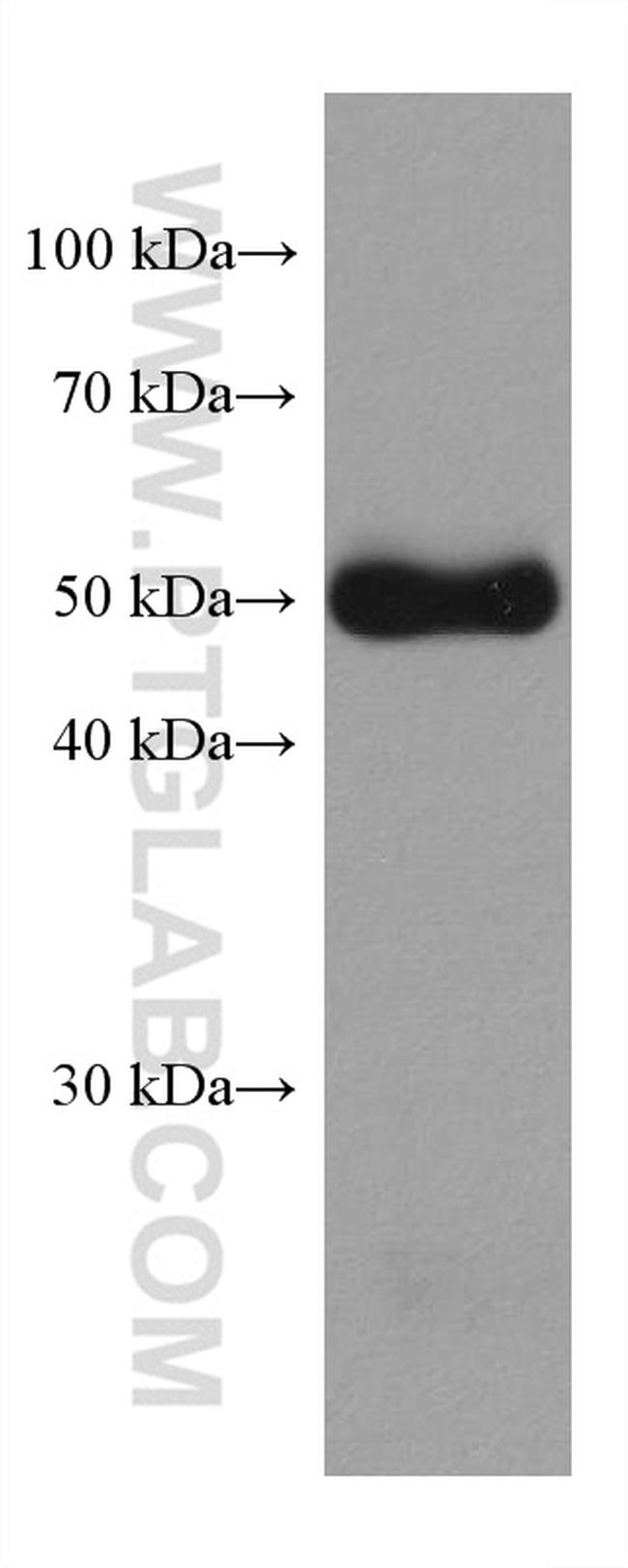 Desmin Antibody in Western Blot (WB)