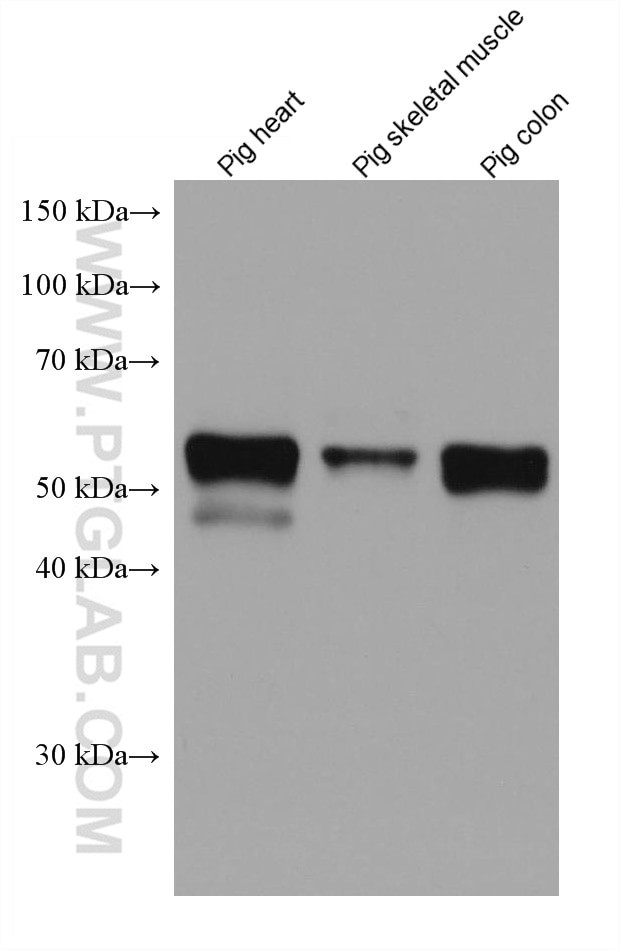 Desmin Antibody in Western Blot (WB)