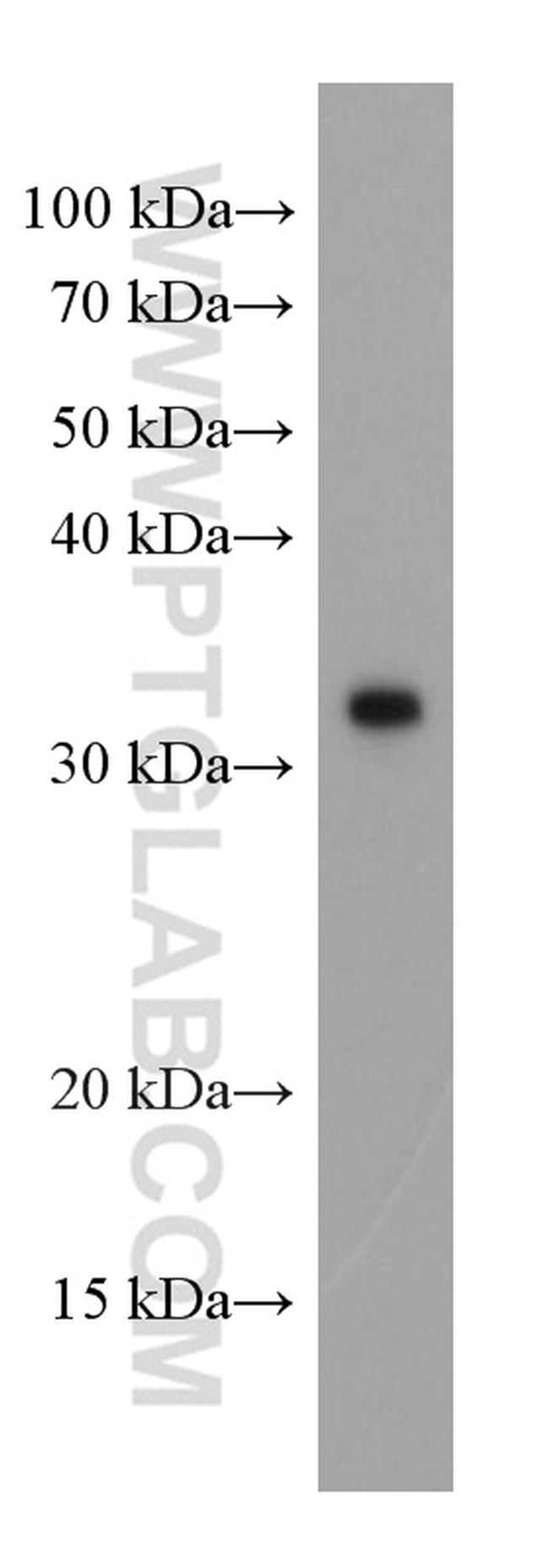 SARS-CoV-2 S protein (944-1214 aa) Antibody in Western Blot (WB)