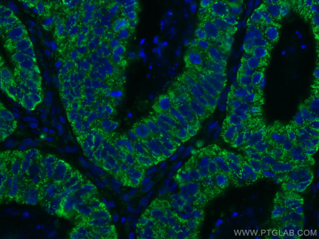 CNOT4 Antibody in Immunohistochemistry (Paraffin) (IHC (P))