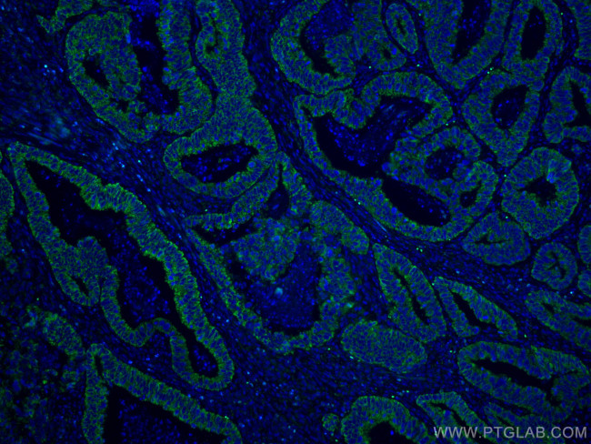 CNOT4 Antibody in Immunohistochemistry (Paraffin) (IHC (P))