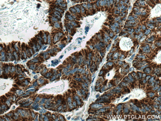 CNOT4 Antibody in Immunohistochemistry (Paraffin) (IHC (P))