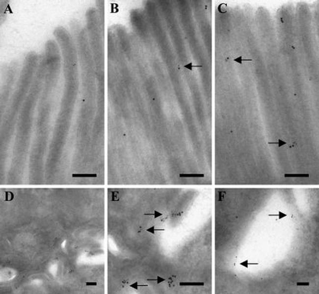 Leptin Antibody in Immunomicroscopy (IM)