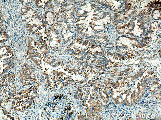 HK3 Antibody in Immunohistochemistry (Paraffin) (IHC (P))