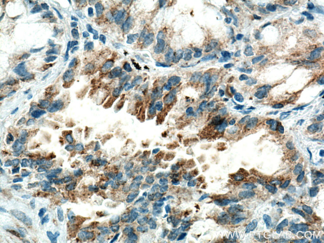 HK3 Antibody in Immunohistochemistry (Paraffin) (IHC (P))