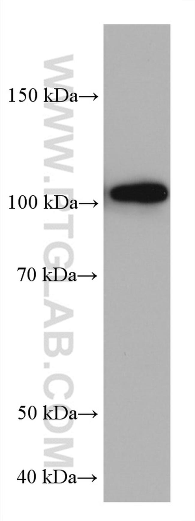 HK3 Antibody in Western Blot (WB)