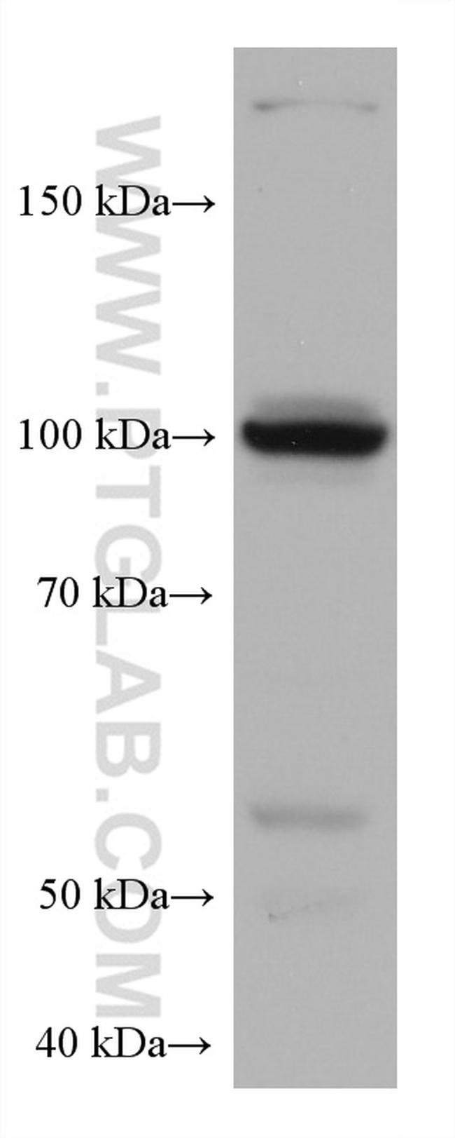 HK3 Antibody in Western Blot (WB)